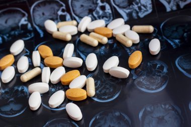 Farklı ilaç tıp hapları beyin manyetik rezonans Mr'ı arka plan tarama. Eczane Tema, sağlık, tümör, alzheimer, akıl hastalığı tedavi ilaç tedavisi için ilaç reçete