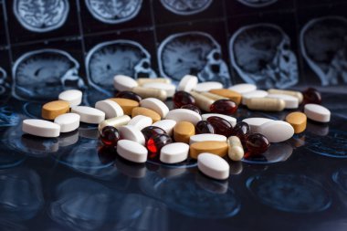 Farklı ilaç tıp hapları beyin manyetik rezonans Mr'ı arka plan tarama. Eczane Tema, sağlık, tümör, alzheimer, akıl hastalığı tedavi ilaç tedavisi için ilaç reçete