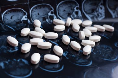 Beyaz ilaç tıp hapları beyin manyetik rezonans Mr'ı arka plan tarama. Eczane Tema, sağlık, tümör, alzheimer, akıl hastalığı tedavi ilaç tedavisi için ilaç reçete