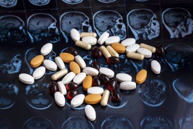 Farklı ilaç tıp hapları beyin manyetik rezonans Mr'ı arka plan tarama. Eczane Tema, sağlık, tümör, alzheimer, akıl hastalığı tedavi ilaç tedavisi için ilaç reçete