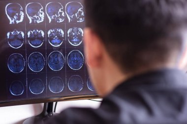 MRI x-ray tarama bilgisayar ekranında görüntü tarama beyin, baş ve CT bakarak hastanede doktor radyolog. Seçici odak fotoğrafçılık