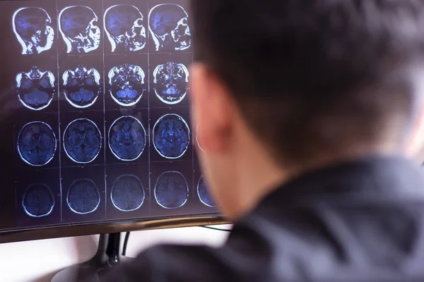 Médico Radiólogo Hospital Mirando Radiografía Resonancia Magnética Cerebro Cabeza Cráneo — Foto de Stock
