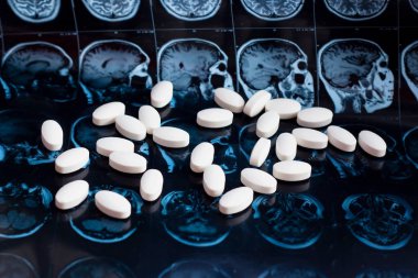 Beyaz ilaç tıp hapları beyin manyetik rezonans Mr'ı arka plan tarama. Eczane Tema, sağlık, tümör, alzheimer, akıl hastalığı tedavi ilaç tedavisi için ilaç reçete