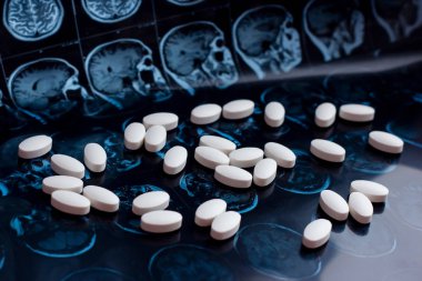 Beyaz ilaç tıp hapları beyin manyetik rezonans Mr'ı arka plan tarama. Eczane Tema, sağlık, tümör, alzheimer, akıl hastalığı tedavi ilaç tedavisi için ilaç reçete