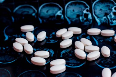 Beyaz ilaç tıp hapları beyin manyetik rezonans Mr'ı arka plan tarama. Eczane Tema, sağlık, tümör, alzheimer, akıl hastalığı tedavi ilaç tedavisi için ilaç reçete