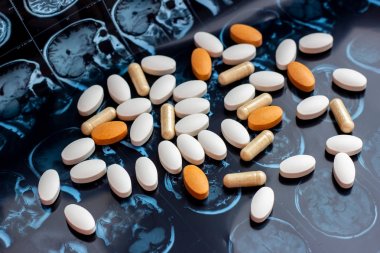 Manyetik beyin rezonans tarama Mr arka planda ilaç ilaç hapları. Eczacılık teması, sağlık, tümör için ilaç reçetesi, Alzheimer, zihinsel hastalık tedavi ilacı