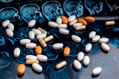 Farklı ilaç tıp hapları beyin manyetik rezonans Mr'ı arka plan tarama. Eczane Tema, sağlık, tümör, alzheimer, akıl hastalığı tedavi ilaç tedavisi için ilaç reçete