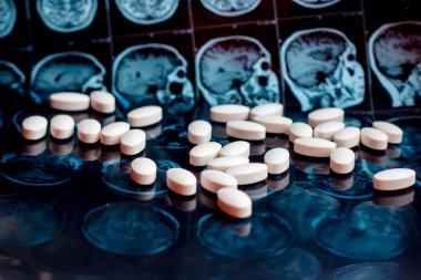 Beyaz ilaç tıp hapları beyin manyetik rezonans Mr'ı arka plan tarama. Eczane Tema, sağlık, tümör, alzheimer, akıl hastalığı tedavi ilaç tedavisi için ilaç reçete