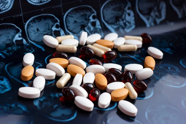 Manyetik beyin rezonans tarama Mr arka planda ilaç ilaç hapları. Eczacılık teması, sağlık, tümör için ilaç reçetesi, Alzheimer, zihinsel hastalık tedavi ilacı