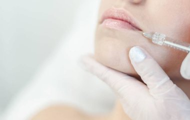 Dudaklarındaki Hyaluronik Asit iğnesi