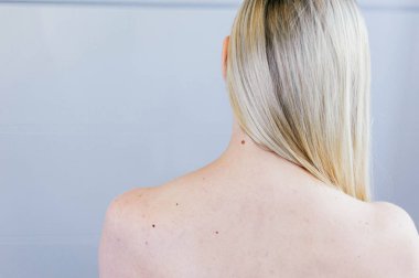 Omuzlar Mole yakın çekim