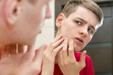 Sorunlu cilt ve izleri ile genç çekici adam yakın