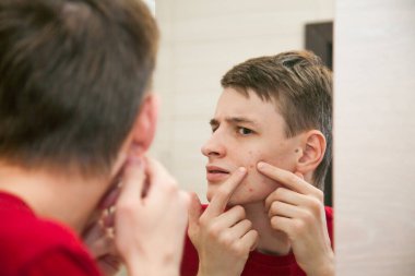 Cildi sorunlu ve sivilceden yara almış genç ve çekici bir adam aynaya bakar ve sivilcelerini sıkar.