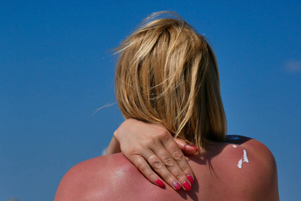 Woman rubs sunscreen on his shoulder. Against the background of the sea.