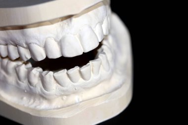 İnsan dişleri alçı yapılmış