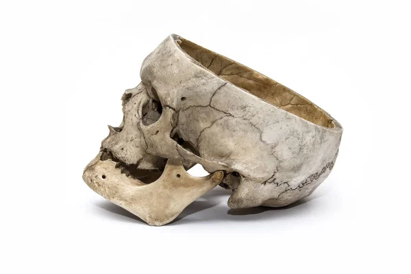 Cráneo Humano Desde Costado Sobre Fondo Blanco — Foto de Stock