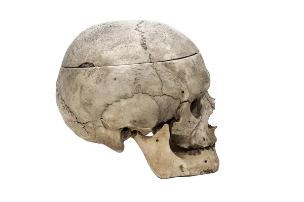 Cráneo Humano Desde Costado — Foto de Stock