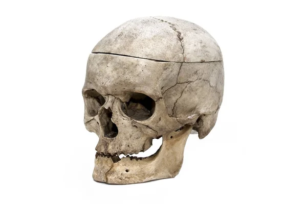 Cráneo Humano Los Tres Cuartos — Foto de Stock