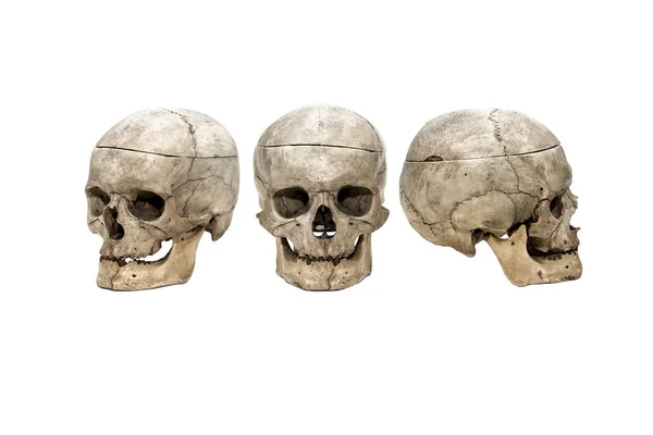 Cráneo Humano Tiene Tres Posiciones Con Mandíbula — Foto de Stock