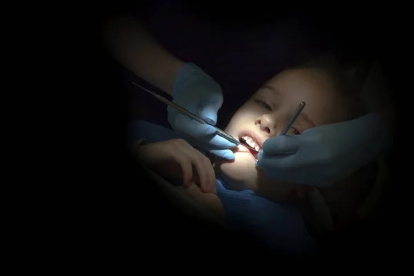 Little girl repairing teeth in dental office — Stock Photo, Image
