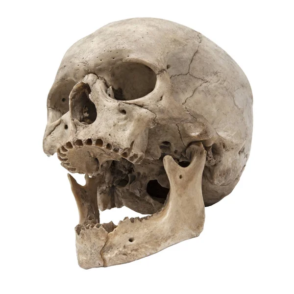 Old human skull bottom view without teeth Royalty Free Stock Photos