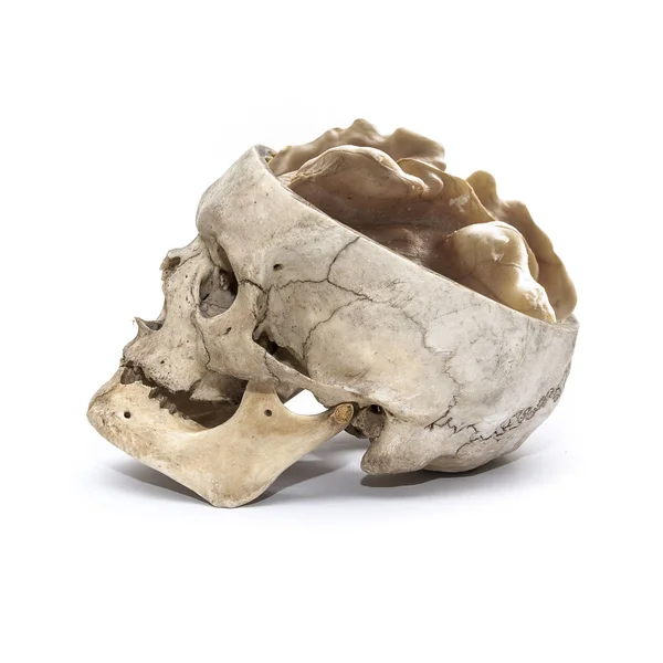 Vista lateral del cráneo humano con nuez en lugar de cerebro — Foto de Stock