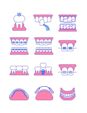 Dental clinic surgery services thin line vector icons. Dental implant, bridge, veneer, crown concepts. Orthodontic treatment such as metal, ceramic, lingual, plastic braces. Removable denture symbol clipart