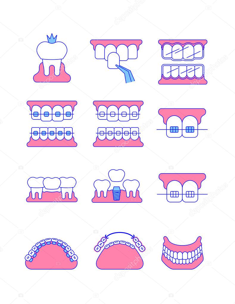 Dental clinic surgery services thin line vector icons. Dental implant, bridge, veneer, crown concepts. Orthodontic treatment such as metal, ceramic, lingual, plastic braces. Removable denture symbol