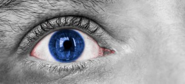 İnsan gözü stres ve panik altında. Gözlerdeki kılcal damarlar. İlaçlar. Psikolochia. İşle ilgili sorunlar. Metin için alanı kopyala.