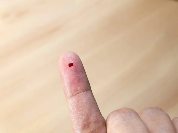 Acercamiento del dedo femenino con gota de sangre para análisis de sangre —  Fotos de Stock