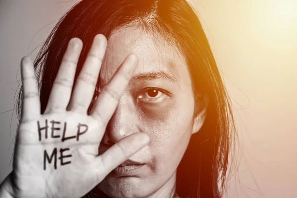 Stoppa våldet mot kvinno kampanjen. Asien kvinna med blåmärke på armar och ansikte höjde handen för att avskräcka, hand skriva ordet hjälp mig. — Stockfoto