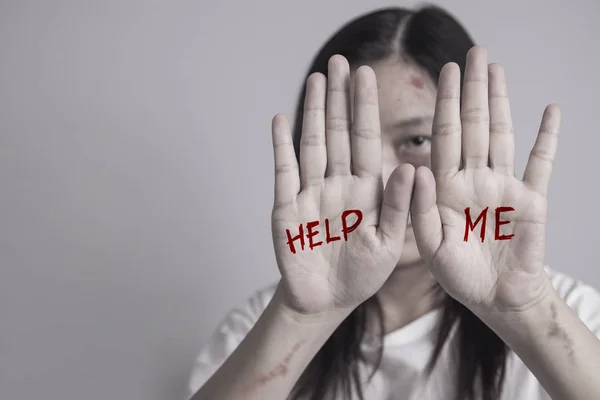 Stoppa våldet mot kvinno kampanjen. Asien kvinna med blåmärke på armar och ansikte höjde handen för att avskräcka, hand skriva ordet hjälp mig. — Stockfoto