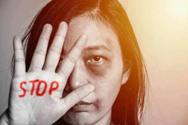 Stoppa våldet mot kvinno kampanjen. Asien kvinna med blåmärke på armar och ansikte höjde handen för att avskräcka, hand skriva ordet stopp i röd färg. — Stockfoto