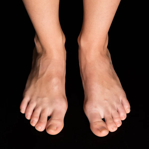 Догляд за ногами на чорному тлі — стокове фото