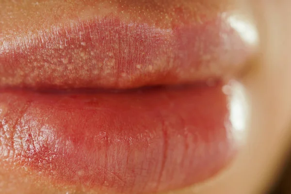 Vrouw Groot Sensueel Lippen Een Witte Achtergrond Close Vrouw Zonder — Stockfoto