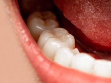 Asyalı Çinli Tay kadın kadın makyaj yüz closeup çekim. Kırmızı dudaklar ruj ve sağlıklı diş beyaz harika mükemmel dişleri olan kadın. Gülümseyen, diş dişçi kliniğine kavram. ağız açık. yirmilik diş
