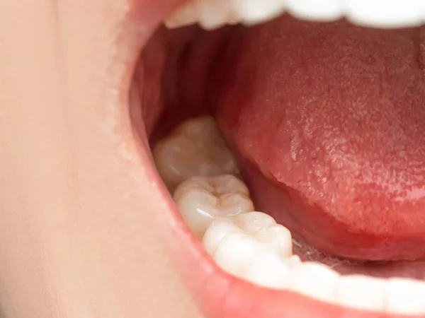 Mouth open. wisdom tooth — https://st4.depositphotos.com/23583802/24900/i/450/depositphotos_249009560-stock-photo-closeup-shot-of-asian-chinese.jpg