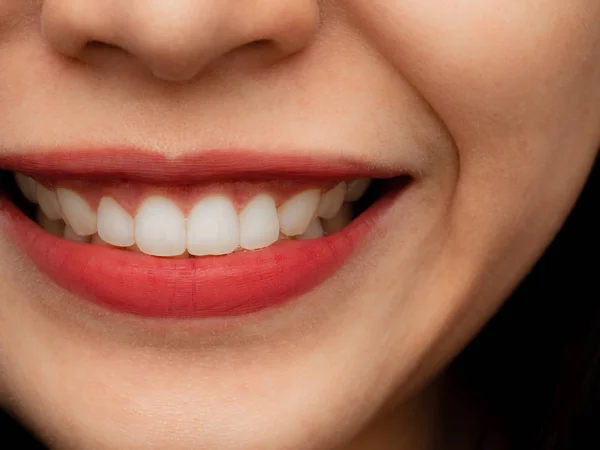 Close-up tiro de humano asiático chinês tailandês mulher rosto de maquiagem feminina. Mulher com lábios vermelhos batom e dentes perfeitos saudáveis dental branco grande. Sorrindo, Clínica odontológica conceito sobre fundo preto — Fotografia de Stock