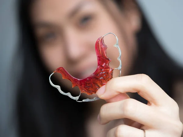 Retrato de una hermosa paciente asiática sosteniendo retenedores de ortodoncia en una clínica dental, Smiling Girl Holding blue Retainer, aparatos ortopédicos para dientes. Ortodoncia Tema dental, Métodos de corrección de dientes —  Fotos de Stock