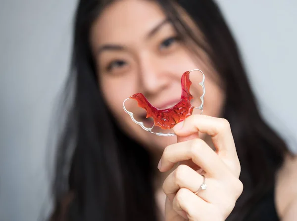 Portrait of beautiful Asian patient woman holding orthodontic retainers in dental clinic, Smiling Girl Holding blue Retainer, Braces for Teeth. Orthodontics Dental Theme, Methods of Teeth Correction — Stock Photo, Image
