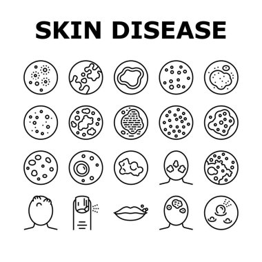 Skin Disease Symptom Collection Icons Set Vector. Skin Cancer And Acne, Vitiligo And Bruise, Eczema And Chronic Blistering, Herpes And Mycosis Black Contour Illustrations clipart