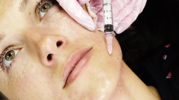 Mujer joven consiguiendo biorevitalización de la cara procedure.and lifting facial — Vídeo de stock