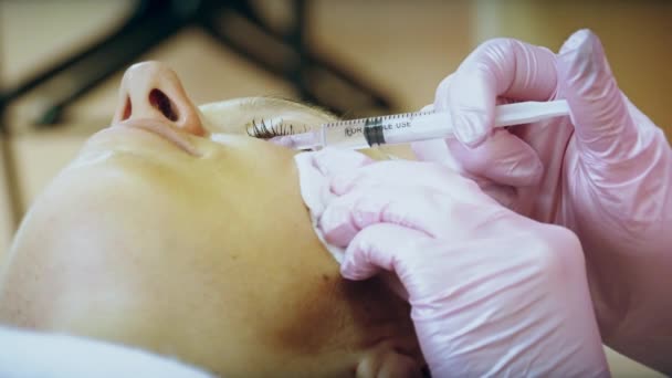 Cosmetoloog maakt gezicht tillen injectie — Stockvideo