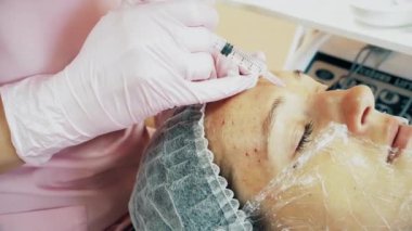 Doktor yüz germe enjeksiyonu yapar