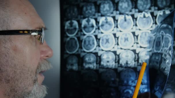 Médico en el hospital revisando resonancia magnética cerebral — Vídeo de stock