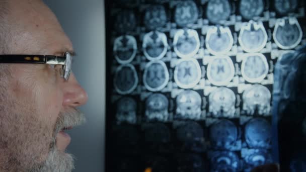 Старший врач рассматривает МРТ мозга — стоковое видео