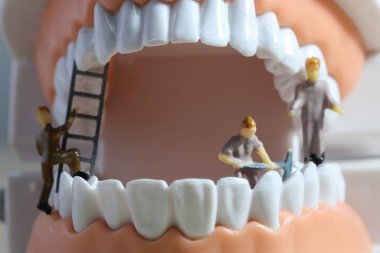 Minyatür insanlar veya küçük figürler tıbbi ve sağlık kavramı olarak diş modeli temizlik. Diş veya diş hekimi fikri için diş modeli üzerinde temizlik ekibi çalışması