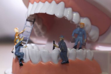 Minyatür insanlar veya küçük figürler tıbbi ve sağlık kavramı olarak diş modeli temizlik. Diş veya diş hekimi fikri için diş modeli üzerinde temizlik ekibi çalışması