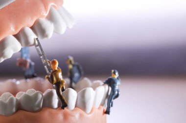 Minyatür insanlar veya küçük figürler tıbbi ve sağlık kavramı olarak diş modeli temizlik. Diş veya diş hekimi fikri için diş modeli üzerinde temizlik ekibi çalışması