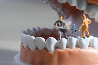 Minyatür insanlar veya küçük figürler tıbbi ve sağlık kavramı olarak diş modeli temizlik. Diş veya diş hekimi fikri için diş modeli üzerinde temizlik ekibi çalışması